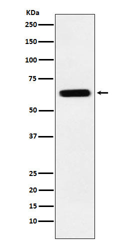 Western blot analysis of CRMP5 expression in SH-SY5Y cell lysate.