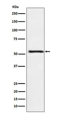 Western blot analysis of ATP4B expression in HepG2 cell lysate.