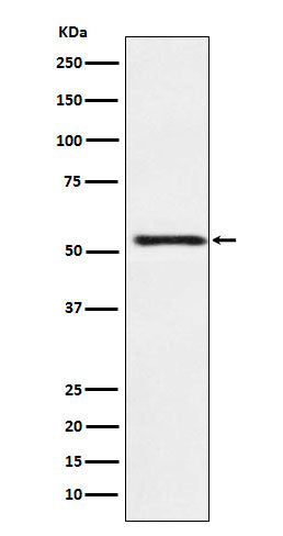 Western blot analysis of ATP4B expression in HepG2 cell lysate.