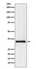 Western blot analysis of U1A expression in Jurkat cell lysate.