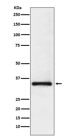 Western blot analysis of U1A expression in Jurkat cell lysate.