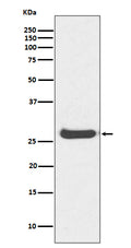 Western blot analysis of Histone H1.0 expression in Human kidney lysate.