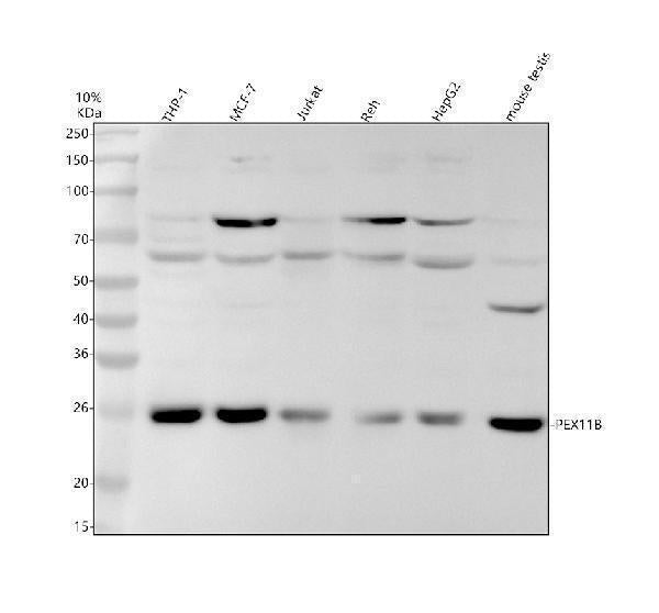 Anti-PEX11B Rabbit Monoclonal Antibody