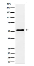 Western blot analysis of GPRC5B expression in Jurkat cell lysate.