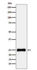 Western blot analysis of PSMA2 expression in HepG2 cell lysate.