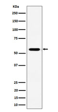 Western blot analysis of RNF14 expression in Jurkat cell lysate.