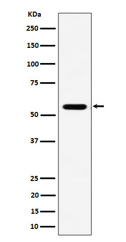 Western blot analysis of RNF14 expression in Jurkat cell lysate.