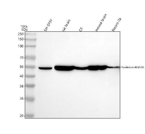 Anti-Tubulin beta 4B/2A/2B Rabbit Monoclonal Antibody