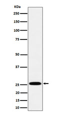 Western blot analysis of TEMT expression in A549 cell lysate.