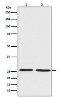 Western blot analysis of BNIP1 expression in (1) Jurkat cell lysate; (2) C6 cell lysate.