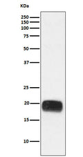 Western blot analysis of Mammaglobin A expression in Human breast cancer lysate.