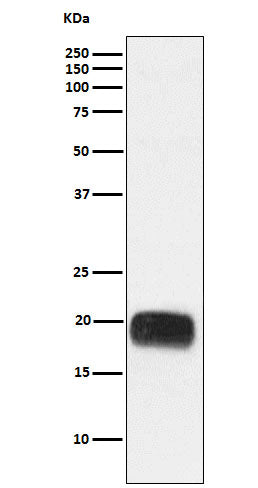 Western blot analysis of Mammaglobin A expression in Human breast cancer lysate.