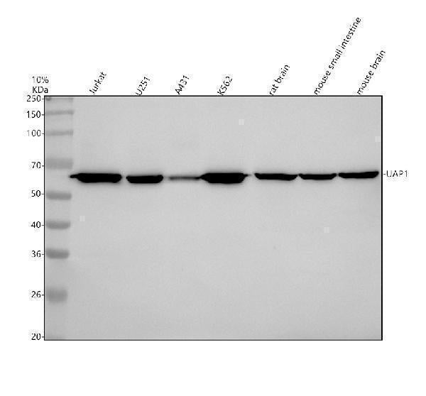 Anti-UAP1 Rabbit Monoclonal Antibody