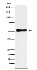 Western blot analysis of ROR beta expression in HepG2 cell lysate.