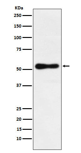 Western blot analysis of ROR beta expression in HepG2 cell lysate.