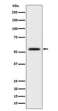 Western blot analysis of p60 katanin expression in HeLa cell lysate.