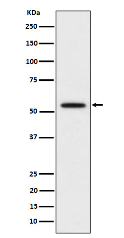 Western blot analysis of p60 katanin expression in HeLa cell lysate.