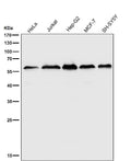 All lanes use the Antibody at 1:2W dilution for 1 hour at room temperature.