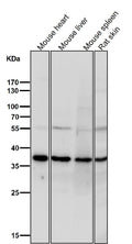 All lanes use the Antibody at 1:1K dilution for 1 hour at room temperature.