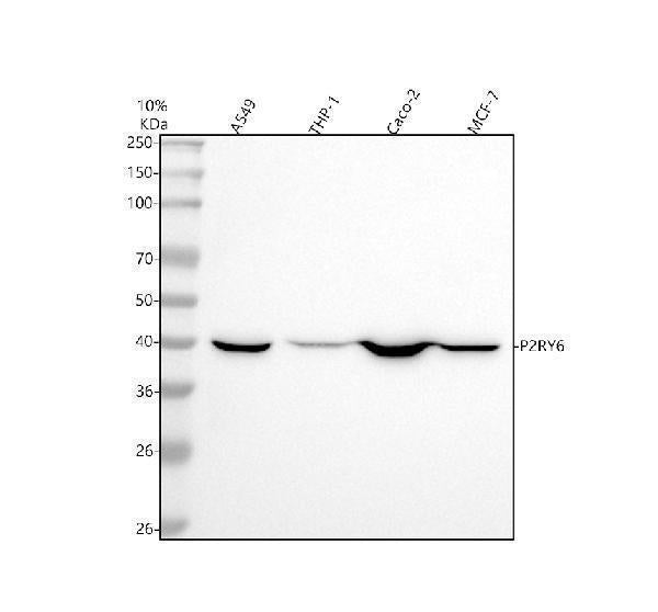 Anti-P2Y6 Rabbit Monoclonal Antibody
