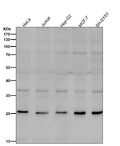All lanes use the Antibody at 1:1K dilution for 1 hour at room temperature.
