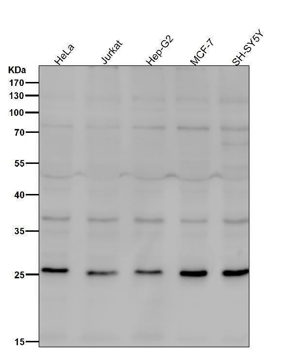 All lanes use the Antibody at 1:1K dilution for 1 hour at room temperature.