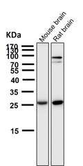 All lanes use the Antibody at 1:5K dilution for 1 hour at room temperature.