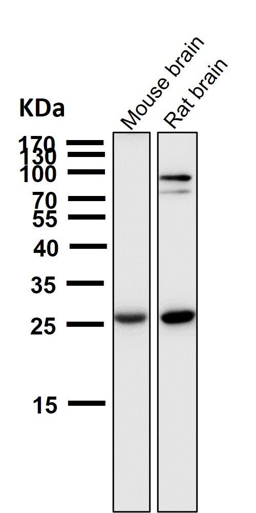 All lanes use the Antibody at 1:5K dilution for 1 hour at room temperature.