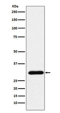 Western blot analysis of GTF2F2 expression in HeLa cell lysate.