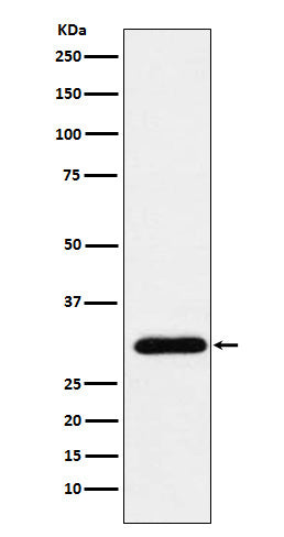 Western blot analysis of GTF2F2 expression in HeLa cell lysate.