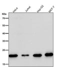 All lanes use the Antibody at 1:1W dilution for 1 hour at room temperature.