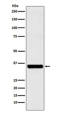 Western blot analysis of EXOSC7 expression in Jurkat cell lysate.