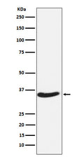 Western blot analysis of EXOSC7 expression in HeLa cell lysate.