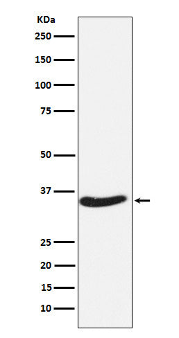 Western blot analysis of EXOSC7 expression in HeLa cell lysate.