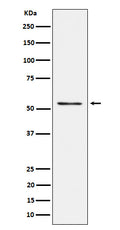 Western blot analysis of Prostein expression in LnCaP cell lysate.