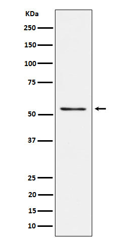 Western blot analysis of Prostein expression in LnCaP cell lysate.