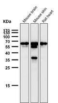 All lanes use the Antibody at 1:1K dilution for 1 hour at room temperature.