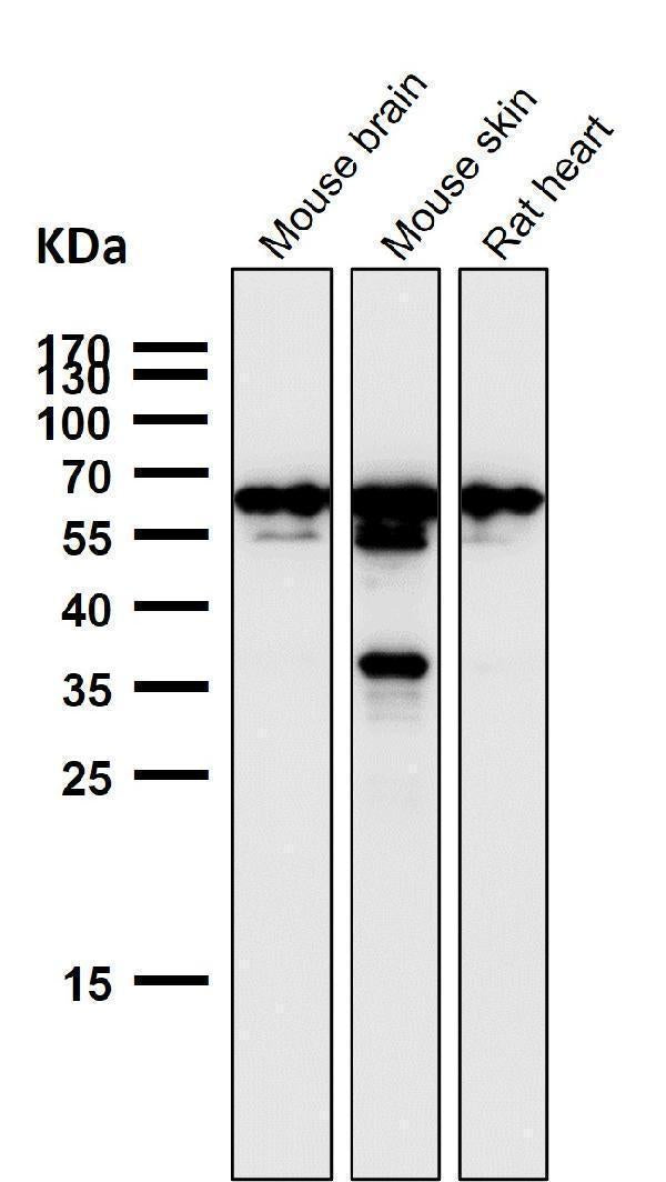 All lanes use the Antibody at 1:1K dilution for 1 hour at room temperature.