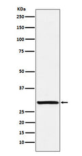Western blot analysis of Intra Acrosomal Protein expression in Human testis lysate.