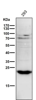 Anti-PPP1R1A Rabbit Monoclonal Antibody