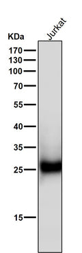 All lanes use the Antibody at 1:1K dilution for 1 hour at room temperature.