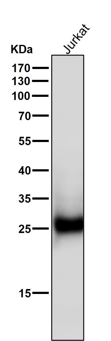 All lanes use the Antibody at 1:1K dilution for 1 hour at room temperature.