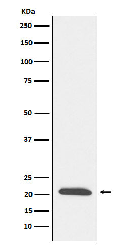 Western blot analysis of DCTN3 expression in SH-SY5Y cell lysate.