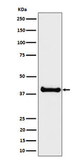Western blot analysis of ALS2CR1 expression in LNCaP cell lysate.