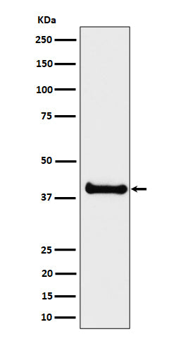 Western blot analysis of ALS2CR1 expression in LNCaP cell lysate.