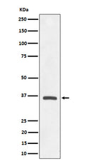 Western blot analysis of OXGR1 / GPR99 expression in A549 cell lysate.