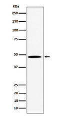 Western blot analysis of HIF Prolyl Hydroxylases expression in HeLa cell lysate.