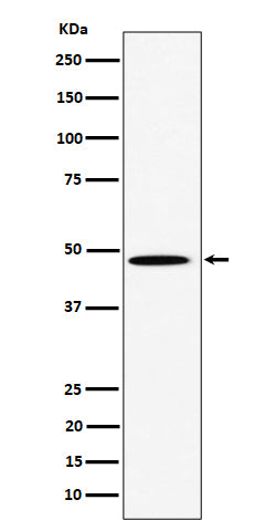 Western blot analysis of HIF Prolyl Hydroxylases expression in HeLa cell lysate.