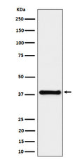 Western blot analysis of UCHL5IP expression in HeLa cell lysate.