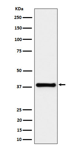 Western blot analysis of UCHL5IP expression in HeLa cell lysate.